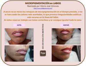 Micro en labios 23-10-2015